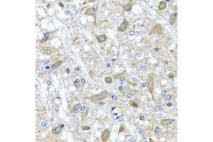 Immunohistochemistry of paraffin-embedded rat brain using SERPINA3 antibody (ABIN5970399) at dilution of 1/100 (40x lens). (SERPINA3 anticorps)