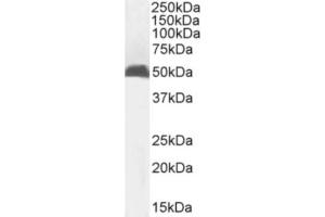 Western Blot using anti-MHC I antibody R1-21. (Recombinant MHC, Class I anticorps)