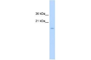 WB Suggested Anti-CENPA Antibody Titration:  1. (CENPA anticorps  (N-Term))