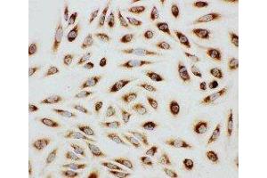 Anti-Paxillin antibody, ICC ICC: HELA Cell