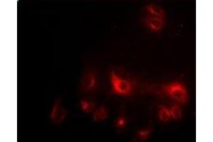 Immunofluorescent analysis of CCAR1 staining in HepG2 cells.