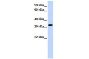 Image no. 1 for anti-Gem (Nuclear Organelle) Associated Protein 2 (GEMIN2) (C-Term) antibody (ABIN6740659)