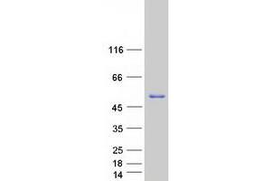 Validation with Western Blot