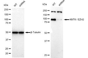 Western blotting analysis using KMT6 / EZH2 antibody (ABIN7798447). (Recombinant EZH2 anticorps)