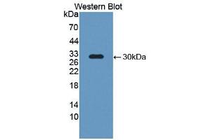 Western blot analysis of the recombinant protein. (NOS2 anticorps  (AA 734-966))