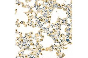 Immunohistochemistry analysis of paraffin embedded mouse lung using contactin-1 (ABIN7073572) at dilution of 1: 300