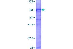 Image no. 1 for Potassium Inwardly-Rectifying Channel, Subfamily J, Member 6 (KCNJ6) protein (GST tag) (ABIN1308452)