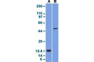 Western blot analysis of Lane 1: recombinant protein, Lane 2: A375 cell lysates with SOX10 monoclonal antibody, clone SOX10/1074 . (SOX10 anticorps  (AA 115-269))