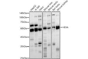 Western blot analysis of extracts of various cell lines, using HEXA antibody (ABIN6127520, ABIN6141731, ABIN6141733 and ABIN6221286) at 1:1000 dilution. (Hexosaminidase A anticorps  (AA 270-529))