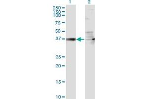 Western Blot analysis of RSAD2 expression in transfected 293T cell line by RSAD2 monoclonal antibody (M01), clone 4D10. (RSAD2 anticorps  (AA 262-361))