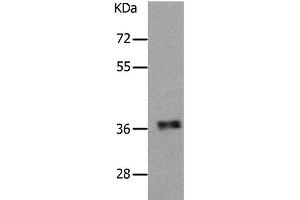 Western Blot analysis of Human fetal muscle tissue using PARD6A Polyclonal Antibody at dilution of 1:650 (PARD6A anticorps)