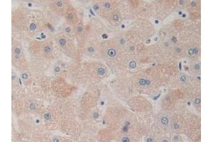 Detection of DRD1 in Human Liver Tissue using Polyclonal Antibody to Dopamine Receptor D1 (DRD1) (Dopamine Receptor d1 anticorps  (AA 338-446))