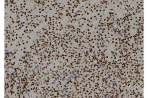 ABIN6279759 at 1/100 staining Mouse kidney tissue by IHC-P. (RGS22 anticorps  (Internal Region))