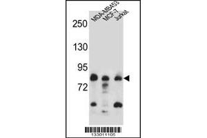 Western blot analysis in MDA-MB453,MCF-7,Jurkat cell line lysates (35ug/lane). (AFG3L2 anticorps  (N-Term))