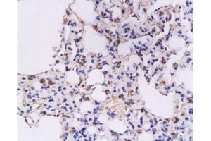 Formalin-fixed and paraffin embedded rat lung tissue labeled with Anti-IFN-gamma Polyclonal Antibody, Unconjugated  at 1:200, followed by conjugation to the secondary antibody and DAB staining