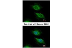 ICC/IF Image Immunofluorescence analysis of methanol-fixed HeLa, using ARF5, antibody at 1:500 dilution. (ARF5 anticorps)