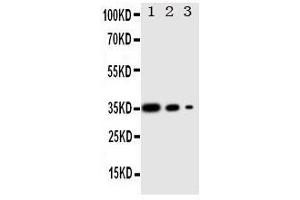 Western Blotting (WB) image for anti-Wingless-Type MMTV Integration Site Family, Member 2B (WNT2B) (AA 169-185), (Middle Region) antibody (ABIN3042967) (WNT2B anticorps  (Middle Region))