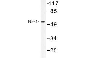 Image no. 1 for anti-Nuclear Factor I/A (NFIA) antibody (ABIN272219) (NFIA anticorps)