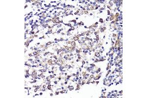 Immunohistochemistry of paraffin-embedded human tonsil using SELL antibody (ABIN3022263, ABIN3022264, ABIN3022265 and ABIN6218704) at dilution of 1:100 (40x lens). (L-Selectin anticorps  (AA 1-100))