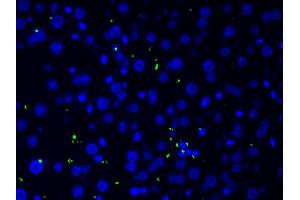 ABIN6266515 at 1/200 staining human liver tissue cells by ICC/IF.