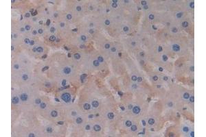 Detection of PDK4 in Mouse Liver Tissue using Polyclonal Antibody to Pyruvate Dehydrogenase Kinase 4 (PDK4)