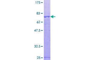 Image no. 1 for Regulatory Associated Protein of mTOR, Complex 1 (RPTOR) (AA 1-379) protein (GST tag) (ABIN1318870)