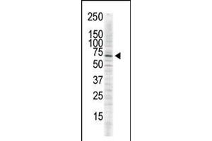 Antibody is used in Western blot to detect CAMK2 delta in serum-starved HeLa cell lysate. (CAMK2D anticorps  (C-Term))