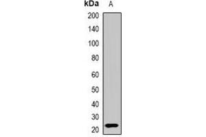 Western blot analysis of Interferon lambda-3 expression in HEK293T (A) whole cell lysates. (IL28B anticorps)
