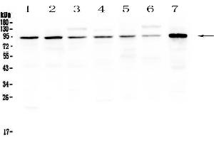 Western blot analysis of SAE2/UBA2 using anti-SAE2/UBA2 antibody . (UBA2 anticorps  (AA 449-564))
