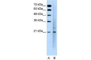 MUC1 antibody used at 0.