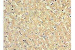 Immunohistochemistry of paraffin-embedded human liver tissue using ABIN7143754 at dilution of 1:100