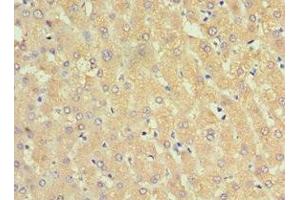 Immunohistochemistry of paraffin-embedded human liver tissue using ABIN7143754 at dilution of 1:100 (SERPINA3 anticorps  (AA 24-423))
