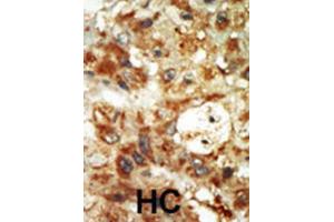 Immunohistochemistry (IHC) image for anti-Mitogen-Activated Protein Kinase 12 (MAPK12) antibody (ABIN5023083) (MAPK12 anticorps)