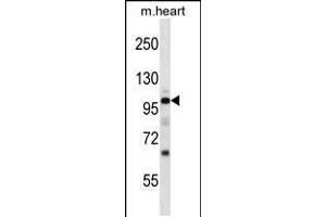 Western blot analysis in mouse heart tissue lysates (35ug/lane). (NPR1 anticorps  (N-Term))