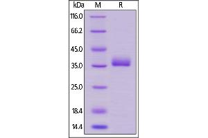 Human Prolactin R, His Tag on  under reducing (R) condition.