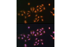 Immunofluorescence analysis of U2OS cells using STK38 antibody (ABIN6132692, ABIN6148616, ABIN6148617 and ABIN6224215) at dilution of 1:100. (STK38 anticorps  (AA 1-200))