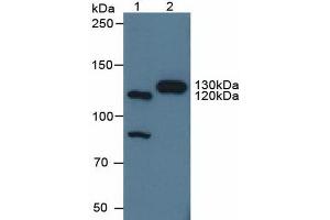 Western blot analysis of (1) Human HeLa cells and (2) Porcine Brain Tissue. (Contactin 4 anticorps  (AA 731-980))
