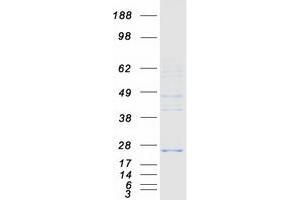Validation with Western Blot (MPV17L2 Protein (Myc-DYKDDDDK Tag))