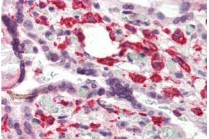 Human Placenta (formalin-fixed, paraffin-embedded) stained with DUSP1 antibody ABIN337195 at 5 ug/ml followed by biotinylated goat anti-rabbit IgG secondary antibody ABIN481713, alkaline phosphatase-streptavidin and chromogen.