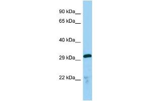 Host:  Rabbit  Target Name:  Tmx2  Sample Type:  Mouse Lung lysates  Antibody Dilution:  1. (TMX2 anticorps  (C-Term))