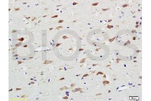 Formalin-fixed and paraffin embedded rat brain labeled with Anti-Nox4/NADH Polyclonal Antibody, Unconjugated (ABIN737526) at 1:200 followed by conjugation to the secondary antibody and DAB staining. (NADPH Oxidase 4 anticorps  (AA 81-180))