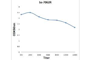 Formalin-fixed and paraffin embedded rat brain labeled with Rabbit Anti DEDD1 Polyclonal Antibody, Unconjugated (ABIN872742) at 1:200 followed by conjugation to the secondary antibody and DAB staining (DEDD anticorps  (AA 151-250))