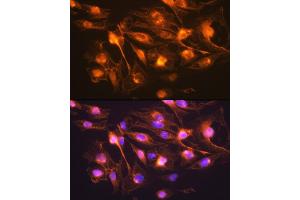 Immunofluorescence analysis of C6 cells using Synaptophysin Rabbit pAb (ABIN6135349, ABIN6148783, ABIN6148784 and ABIN6221958) at dilution of 1:100 (40x lens).