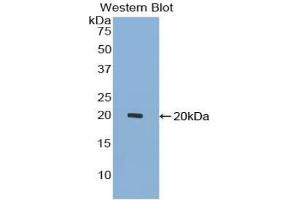 Western blot analysis of the recombinant protein. (GDF7 anticorps  (AA 295-447))