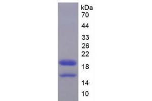 SDS-PAGE analysis of Mouse HMGA1 Protein. (HMGA1 Protéine)