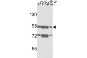 Western Blotting (WB) image for anti-ATP-Binding Cassette, Sub-Family B (MDR/TAP), Member 5 (ABCB5) antibody (ABIN3002513) (ABCB5 anticorps)