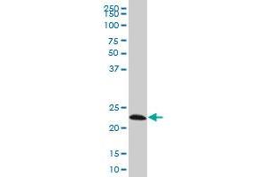 EFHD1 monoclonal antibody (M08A), clone 1F5 Western Blot analysis of EFHD1 expression in Hela S3 NE . (EFHD1 anticorps  (AA 168-238))