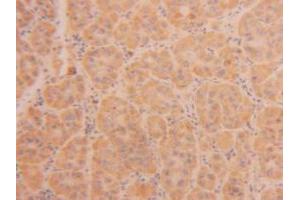 Figure. (TPSAB1 anticorps  (AA 161-262))