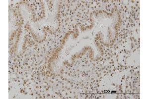 Immunoperoxidase of monoclonal antibody to SCML1 on formalin-fixed paraffin-embedded human endometrium. (SCML1 anticorps  (AA 3-100))