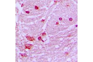 Immunohistochemical analysis of DNAL1 staining in human brain formalin fixed paraffin embedded tissue section. (DNAL1 anticorps  (Center))